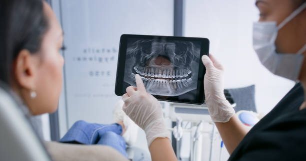 Licensed Tooth Extraction service in Cincinnati, OH - Smile Center Dentistry